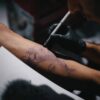 What You Shouldn’t Do Before Your Tattoo Removal Session